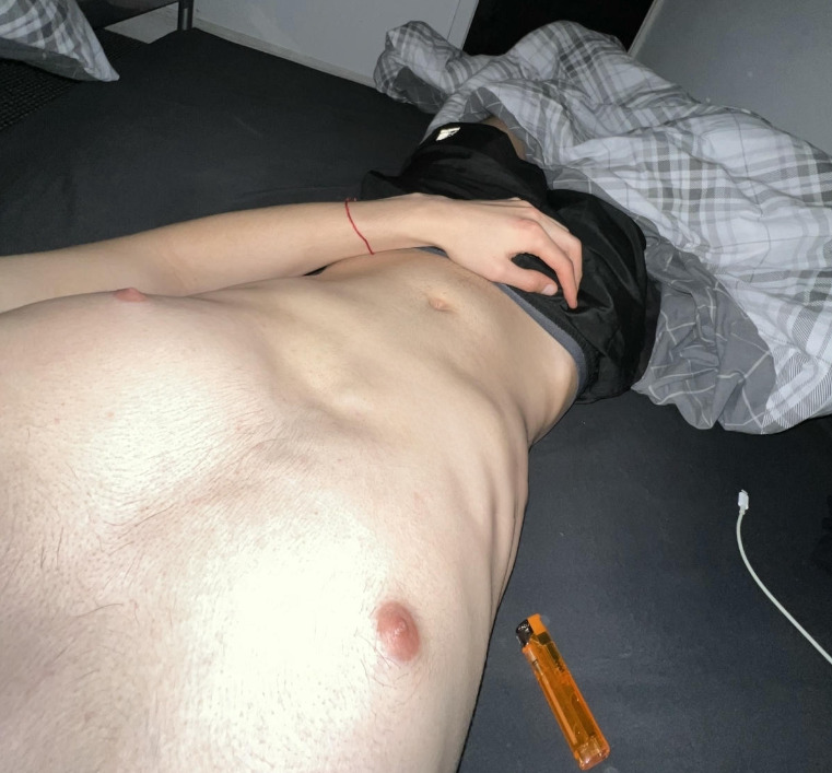 Otto 6
