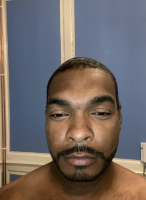 Anthony 2